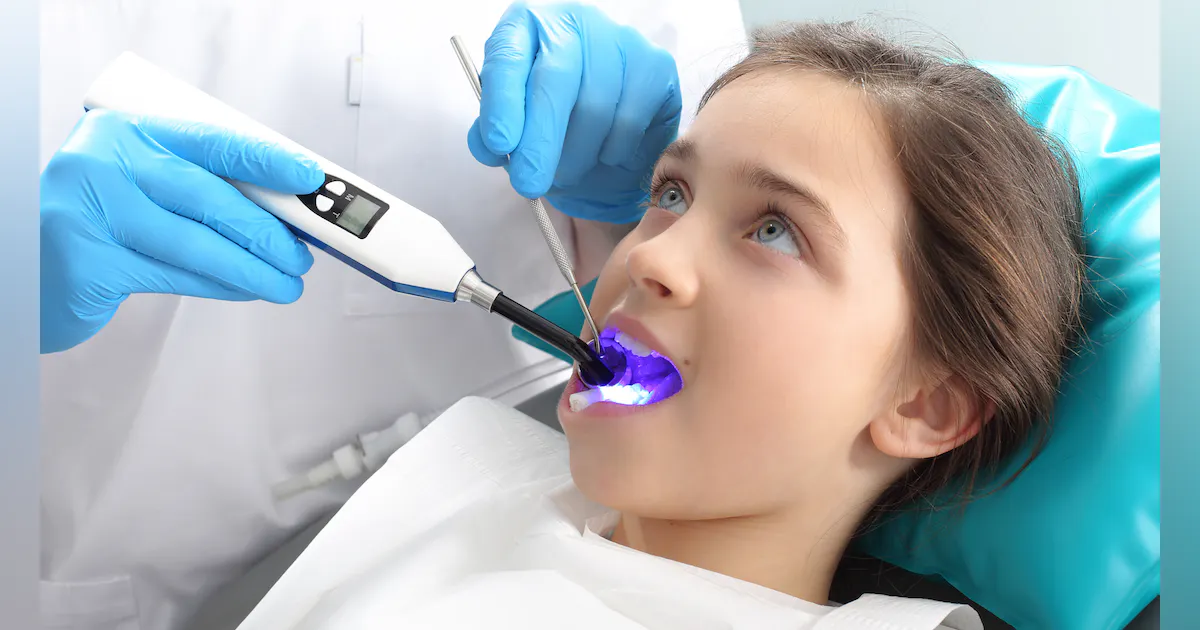 Dental Sealants Exploring the Material Varieties
