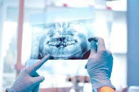 Illuminating the Significance of Dental X-Rays in Oral Healthcare