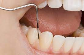The Significance of Regular Periodontal Exams